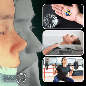 مراقبت‌های پس از رینوپلاستی