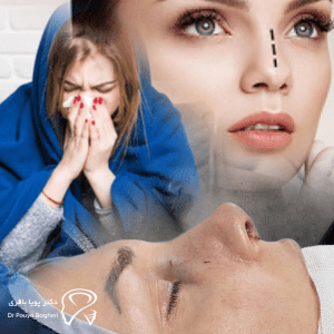 آنچه باید قبل از جراحی بینی بدانید اگر آلرژی دارید