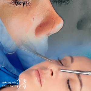 عمل بینی چیست؟