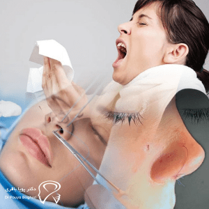 چه مشکلاتی برای بیماران دارای آلرژی بعد از عمل بینی ممکن است رخ دهد؟