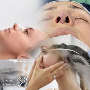 بالا نگه داشتن سر هنگام استراحت