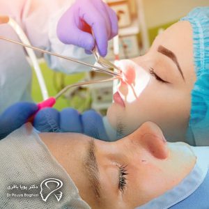 چه کسانی کاندیدای مناسب جراحی بینی به روش باز هستند؟