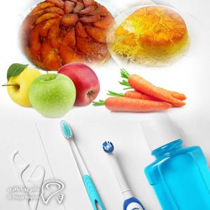 مراقبتهای پس از کاشت ایمپلنت دندان