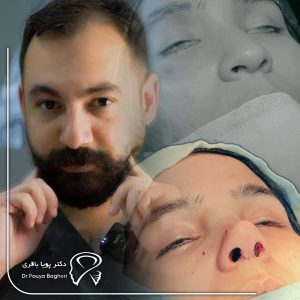 چگونه بهترین جراح برای عمل همزمان زیبایی و درمانی بینی انتخاب کنیم؟