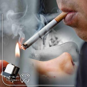 ۵ توصیه طلایی برای پیشگیری از عوارض رینوپلاستی