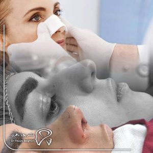 راهکارهای کاربردی برای جلوگیری از عوارض عمل بینی