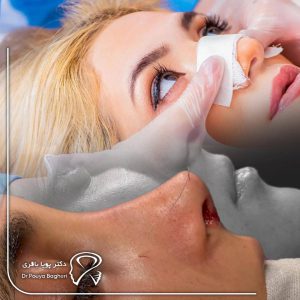 شکستگی بینی چیست و چگونه درمان می‌شود؟