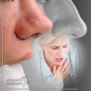 شکستگی بینی چیست و چرا باید سریع درمان شود؟