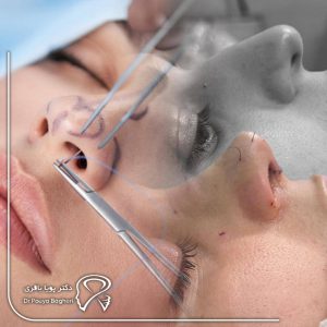 چرا نباید شکستگی بینی را نادیده بگیرید؟