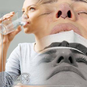 نکات طلایی تغذیهای که نباید فراموش کنید
