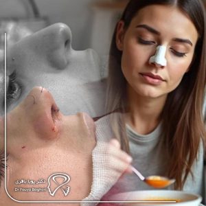 بعد از عمل بینی چی بخوریم