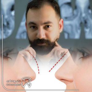 از دیدگاه روحی و روانی: آمادگی ذهنی و انتظارات واقع‌بینانه کلید موفقیت