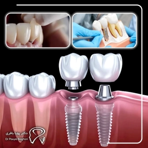 مراقبت و پایش پس از درمان (Follow-up)