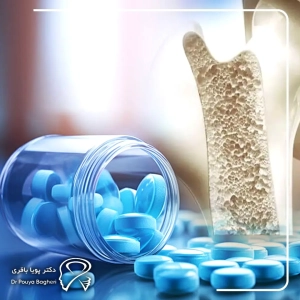 نوع و مدت مصرف داروهای پوکی استخوان (مثل بیسفسفوناتها)