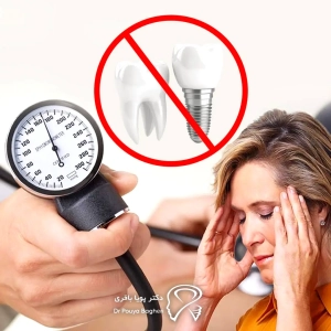 خطرات ایمپلنت برای بیماران با فشار خون بالا