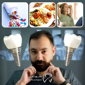 توصیههای دکتر باقری برای ایمپلنت موفق در بیماران پرفشار