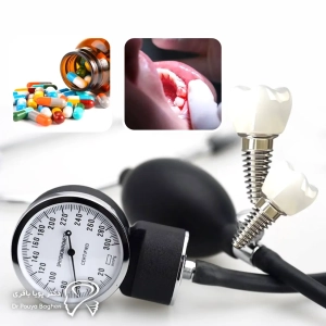 آیا با فشار خون بالا ایمپلنت امکانپذیر است؟