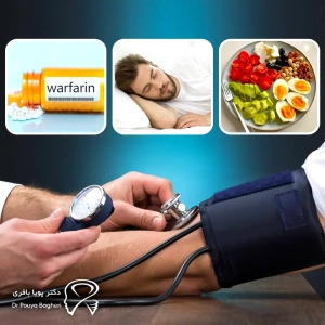 پیشنهادهای کاربردی برای بیماران دارای فشار خون بالا قبل از ایمپلنت