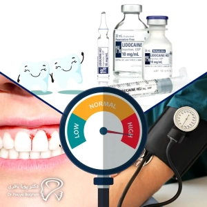 تاثیرات فشار خون بالا بر فرایند کاشت ایمپلنت