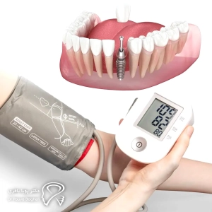 فشار خون بالا و چالشهای کاشت ایمپلنت