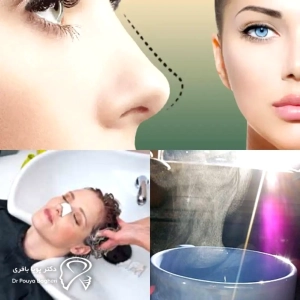 نکات ضروری برای حمام کردن بعد از عمل بینی