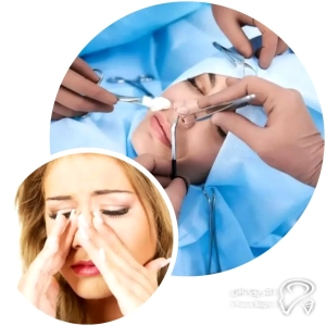 روز ۰ تا ۲ – ممنوع 🚫