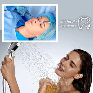 بعد از روز ۷ – تقریباً آزاد