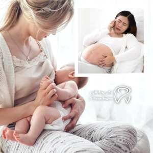 عمل بینی قبل یا بعد از بارداری — بهترین زمان کدام است؟