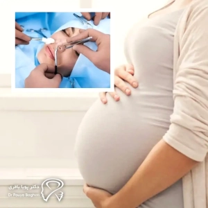 تاثیر بارداری بر جراحی بینی