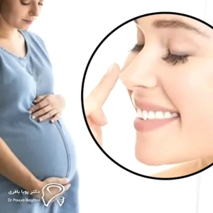 تاثیر بارداری بر جراحی بینی