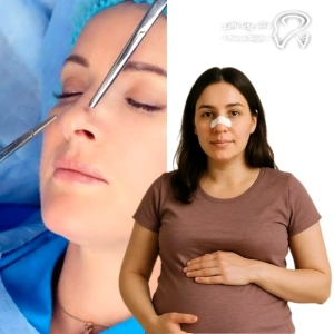 تاثیر بارداری بر جراحی بینی انجام‌شده