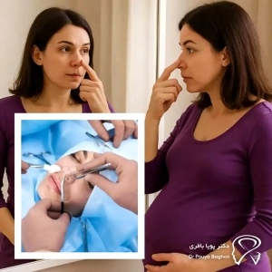 تاثیر بارداری بر جراحی بینی انجام‌شده