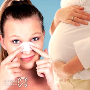 جراحی بینی قبل یا بعد از بارداری؟