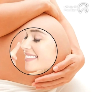 تاثیر بارداری بر جراحی بینی