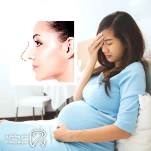 چرا زمان‌بندی جراحی بینی قبل یا بعد از بارداری اهمیت دارد؟