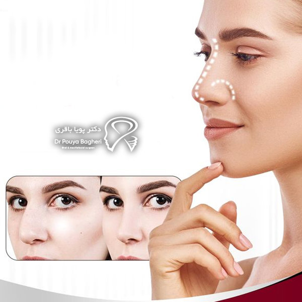عوارض عمل بینی در سن پایین