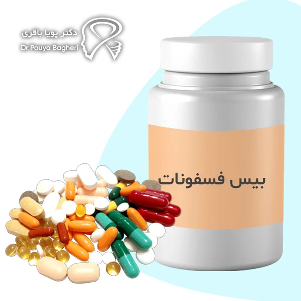مصرف برخی داروهای خاص می‌تواند بر روند ترمیم استخوان و لثه اثر بگذارد