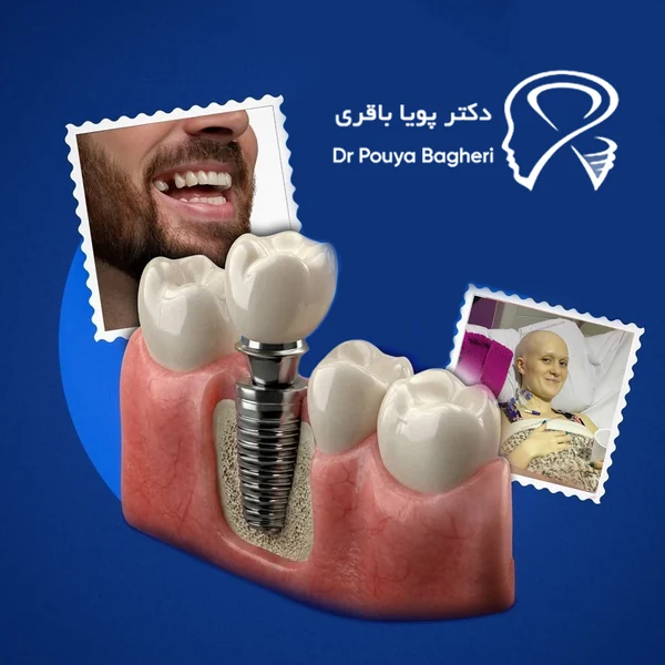 بیماران تازه وارد مرحله شیمی‌درمانی