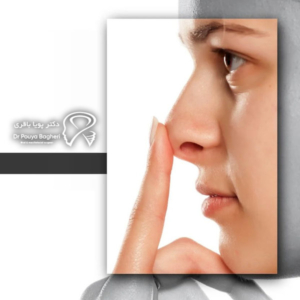تصمیم به جراحی بینی در سن پایین‌تر نیازمند دقت، مشاوره تخصصی و صبر است
