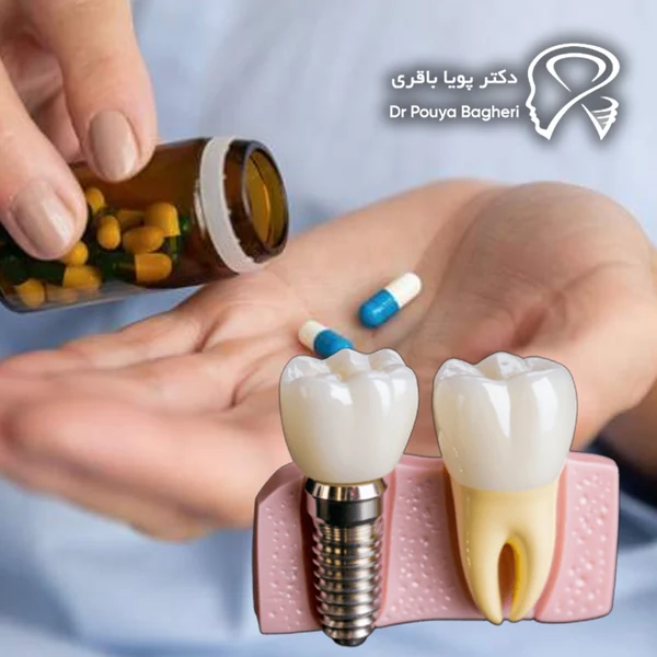 آیا داروهای پوکی استخوان همیشه مانع ایمپلنت هستند؟