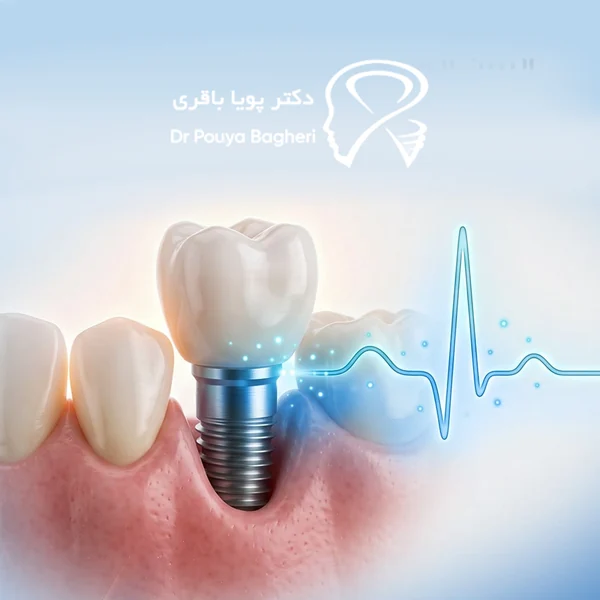 مصرف‌کنندگان بیس‌فسفونات تزریقی طولانی‌مدت