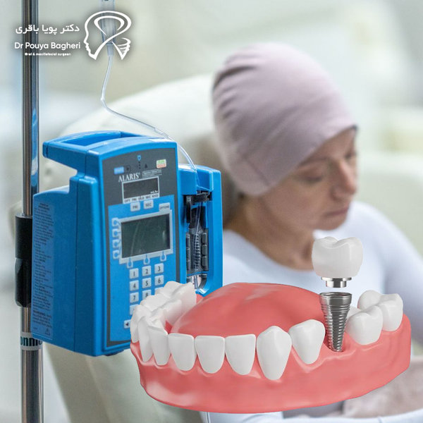 چرا شرایط این بیماران خاص است؟