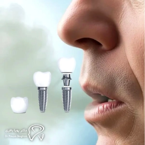 نتیجه‌گیری