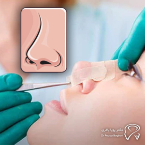 نحوه انجام صحیح شست‌وشوی بینی