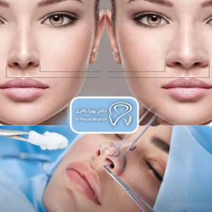 راه‌های جلوگیری از عفونت بعد از عمل بینی