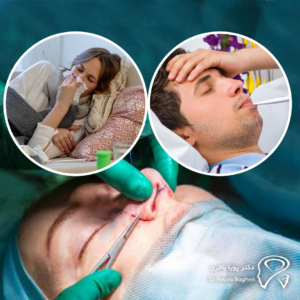 علائم عفونت عمل بینی
