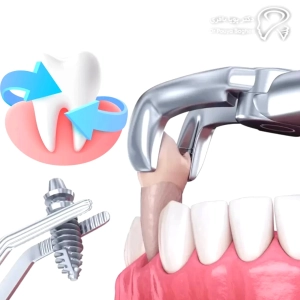 مشکلات زمان‌بندی نادرست