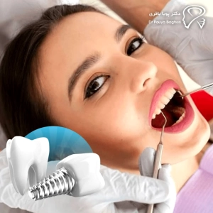 اهمیت بررسی استخوان و لثه