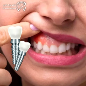 وجود عفونت یا التهاب