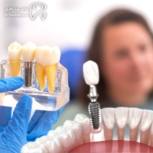 تراکم بافت نرم (لثه)